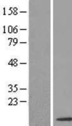 Novus Biologicals&trade;&nbsp;SNRPF Overexpression Lysate