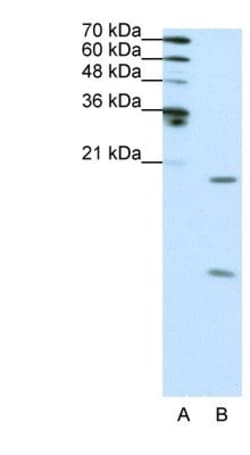 SNRPF Antibody, Novus Biologicals:Antibodies:Primary Antibodies