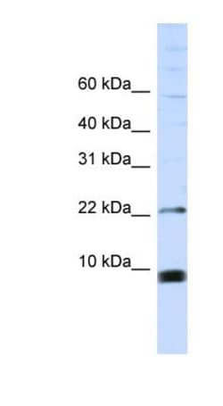 SNRPF Antibody, Novus Biologicals 100&mu;L; Unlabeled:Antibodies, Polyclonal