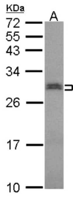 SNRPN Antibody, Novus Biologicals 0.1mL; Unlabeled:Antibodies, Polyclonal