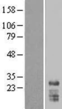 Novus Biologicals™ SNRPN Overexpression Lysate