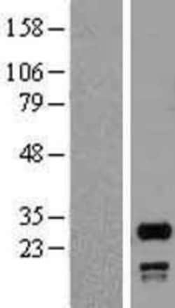 Novus Biologicals&trade;&nbsp;SNRPN Overexpression Lysate
