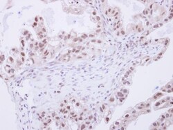 SNW1 Antibody, Novus Biologicals 0.1mL; Unlabeled:Antibodies, Polyclonal