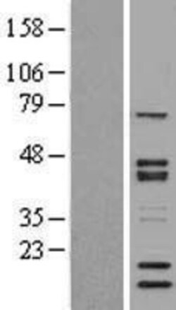 Novus Biologicals&trade;&nbsp;SNW1 Overexpression Lysate
