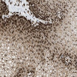 SNW1 Antibody, Novus Biologicals 0.1mL; Unlabeled:Antibodies, Polyclonal