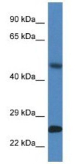SNX10 Antibody, Novus Biologicals:Antibodies:Primary Antibodies