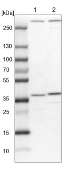 SNX11 Antibody, Novus Biologicals 0.1mL; Unlabeled:Antibodies, Polyclonal