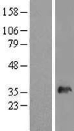 Novus Biologicals&trade;&nbsp;SNX11 Overexpression Lysate