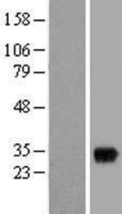 Novus Biologicals&trade;&nbsp;SNX11 Overexpression Lysate