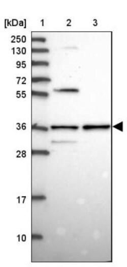 SNX11 Antibody, Novus Biologicals 0.1mL; Unlabeled:Antibodies, Polyclonal