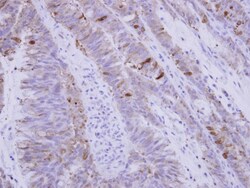 SNX15 Antibody, Novus Biologicals 0.1mL; Unlabeled:Antibodies, Polyclonal