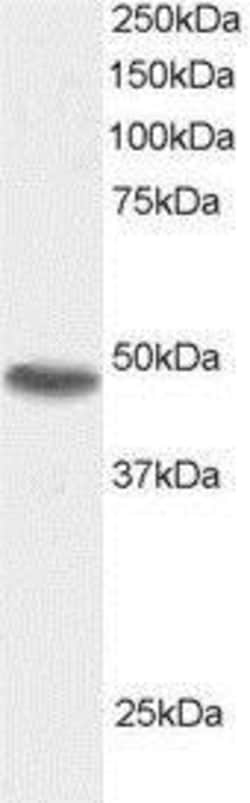 SNX15 Antibody, Novus Biologicals 0.1mg; Unlabeled:Antibodies, Polyclonal