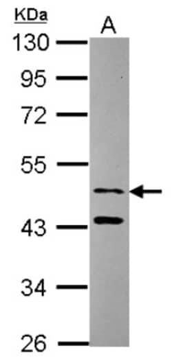 SNX15 Antibody, Novus Biologicals 0.1mL; Unlabeled:Antibodies, Polyclonal