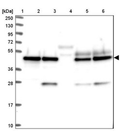 SNX15 Antibody, Novus Biologicals 25 &mu;L | Buy Online | Novus Biologicals | Fisher Scientific