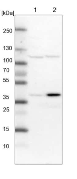 SNX16 Antibody, Novus Biologicals 0.1mL | Buy Online | Novus Biologicals | Fisher Scientific