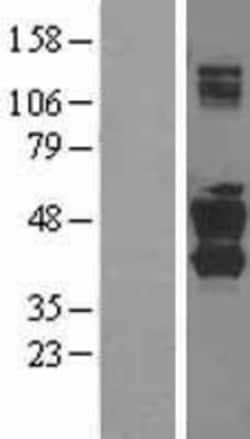 Novus Biologicals™ SNX16 Overexpression Lysate