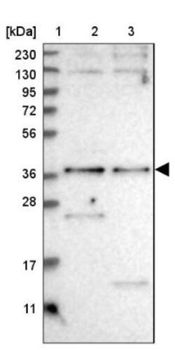 SNX16 Antibody, Novus Biologicals 0.1mL | Buy Online | Novus Biologicals | Fisher Scientific