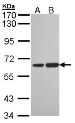 SNX18 Antibody, Novus Biologicals 0.1mg; Unlabeled:Antibodies, Polyclonal