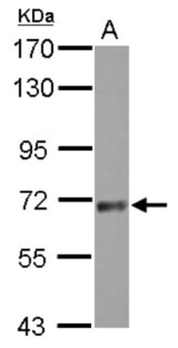 SNX18 Antibody, Novus Biologicals 0.1 mL | Buy Online | Novus Biologicals | Fisher Scientific