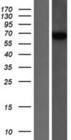 Novus Biologicals™ SNX18 Overexpression Lysate