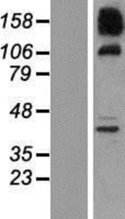 Novus Biologicals&trade;&nbsp;SNX19 Overexpression Lysate