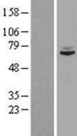 Novus Biologicals&trade;&nbsp;SNX2 Overexpression Lysate