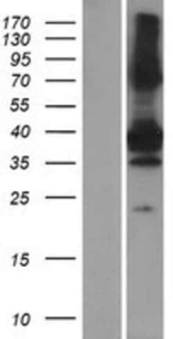 Novus Biologicals&trade;&nbsp;SNX20 Overexpression Lysate