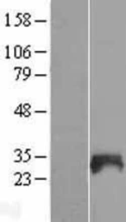 Novus Biologicals&trade;&nbsp;SNX21 Overexpression Lysate