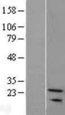 Novus Biologicals&trade;&nbsp;SNX24 Overexpression Lysate