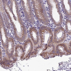 SNX24 Antibody, Novus Biologicals:Antibodies:Primary Antibodies