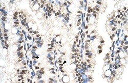 SNX29 Antibody, Novus Biologicals 20&mu;L; Unlabeled:Antibodies, Polyclonal