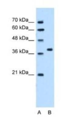 SNX29 Antibody, Novus Biologicals 20&mu;L; Unlabeled:Antibodies, Polyclonal