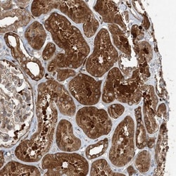 SNX2 Antibody, Novus Biologicals 25 &mu;L | Buy Online | Novus Biologicals | Fisher Scientific