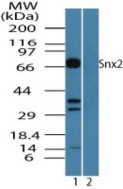 SNX2 Antibody, Novus Biologicals 0.1mg; Unlabeled:Antibodies, Polyclonal