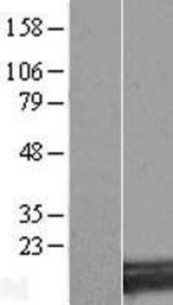 Novus Biologicals™ SNX3 Overexpression Lysate