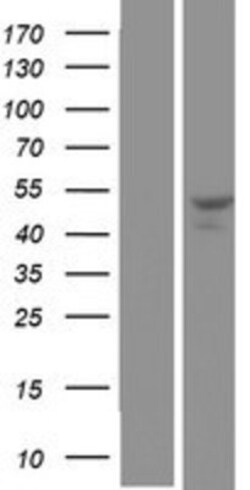 Novus Biologicals&trade;&nbsp;SNX30 Overexpression Lysate