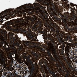 SNX30 Antibody, Novus Biologicals 25 &mu;L; Unlabeled:Antibodies, Polyclonal