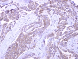 SNX33 Antibody, Novus Biologicals 0.1mL; Unlabeled:Antibodies, Polyclonal