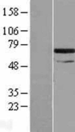 Novus Biologicals&trade;&nbsp;SNX33 Overexpression Lysate