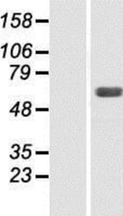 Novus Biologicals&trade;&nbsp;SNX4 Overexpression Lysate