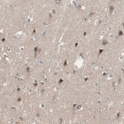 SNX4 Antibody, Novus Biologicals 25 &mu;L; Unlabeled:Antibodies, Polyclonal
