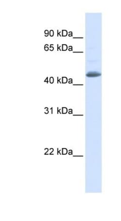 SNX5 Antibody, Novus Biologicals 0.05mg; Unlabeled:Antibodies, Polyclonal