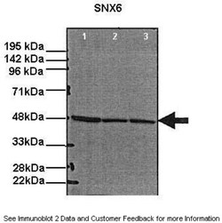 Snx6 Antibody, Novus Biologicals 100&mu;L; Unlabeled:Antibodies, Polyclonal
