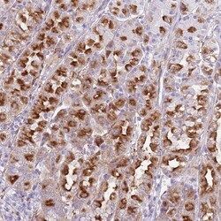 Snx6 Antibody, Novus Biologicals:Antibodies:Primary Antibodies