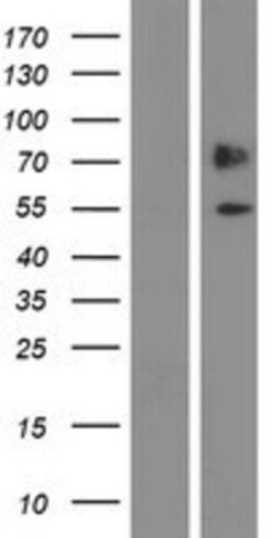 Novus Biologicals&trade;&nbsp;SNX7 Overexpression Lysate