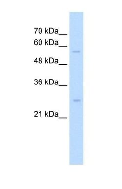 SOCS-1 Antibody, Novus Biologicals 100 ul; Unconjugated:Antibodies, Polyclonal
