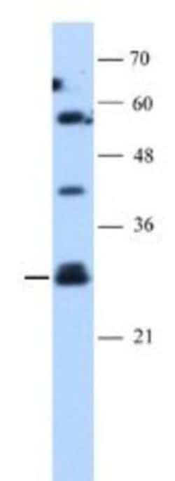 SOCS-1 Antibody, Novus Biologicals 100 ul; Unconjugated:Antibodies, Polyclonal