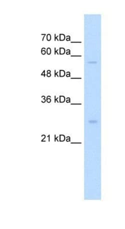 SOCS-1 Antibody, Novus Biologicals 100 ul; Unconjugated:Antibodies, Polyclonal