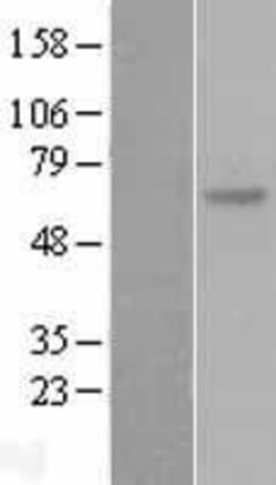 Novus Biologicals&trade;&nbsp;SOCS-5 Overexpression Lysate