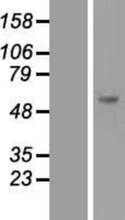 Novus Biologicals™ SOCS-5 Overexpression Lysate